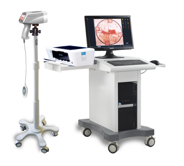 colposcope for sale gynecologic endoscopy examination high Definition Digital Video colposcope