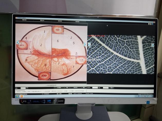 Colposcope For Sale Gynecologic Endoscopy Examination