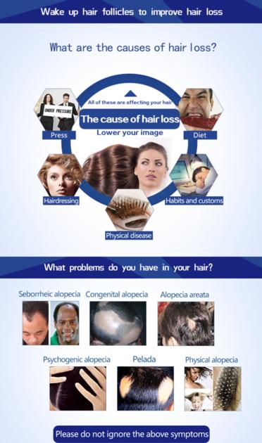 Low Level Laser Hair Loss Equipment