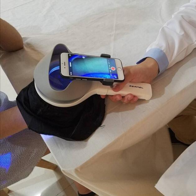 Skin Examination Test Medical Wood S