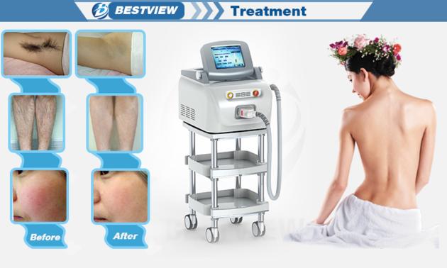 Ipl SHR Laser Hair Removal Machine