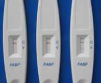 FABP (Fatty Acid Binding Protein) Cardiac Infarction Rapid Test