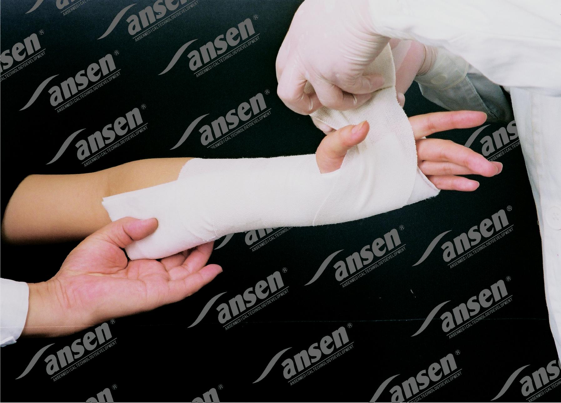 splint