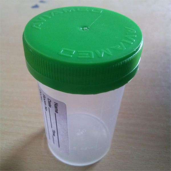 Urine Container 60 mL (2 oz.) Nonsterile