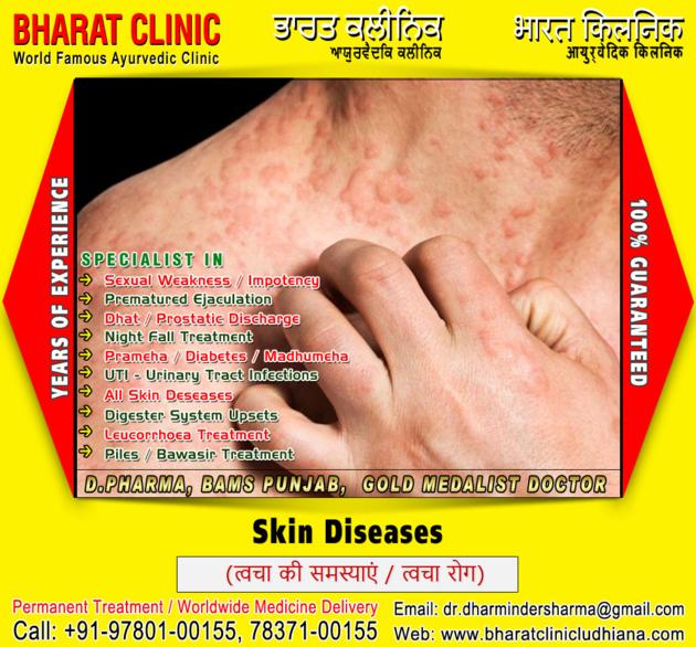Leucorrhoea Treatment Digester System Upsets Skin
