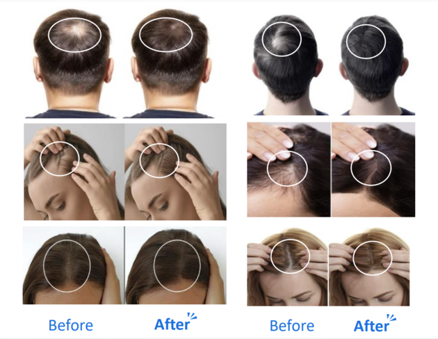 Velash Expert Scalp Treatment 11 Cell