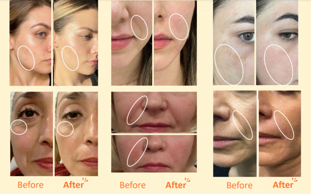 SELASTIN TOX Anti Wrinkle And Glutathione