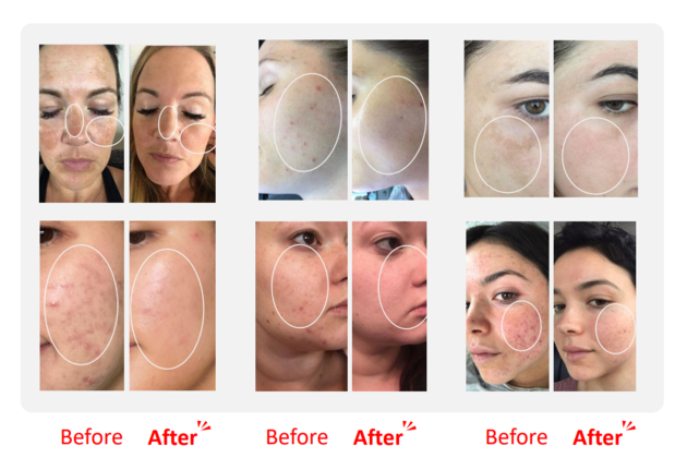 VELATOX Premium Skin Booster With 11