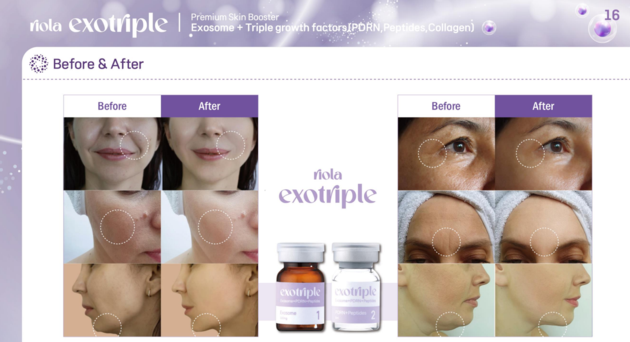 Riola Exotriple CICA Exosome PDRN Collagen