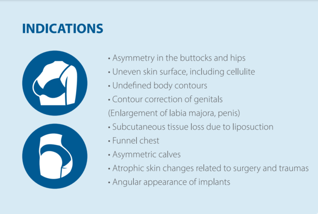 SELASTIN FILLRISE HA Filler For Breast