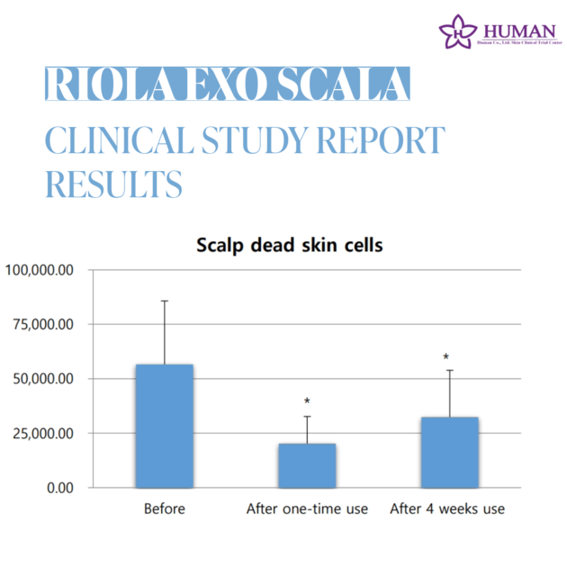 Riola Exo Scala Hair Loss Relief