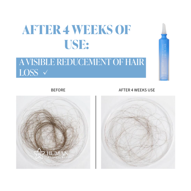 Riola Exo Scala Hair Loss Relief