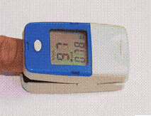 CMS-50B fingertip Oximeter
