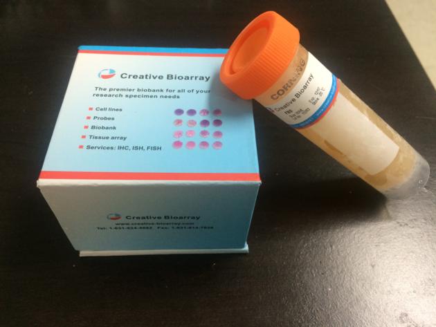 QualiCell&not; Induced Pluripotent Stem Cell-XLC106
