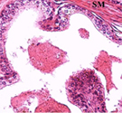 Tissue Block