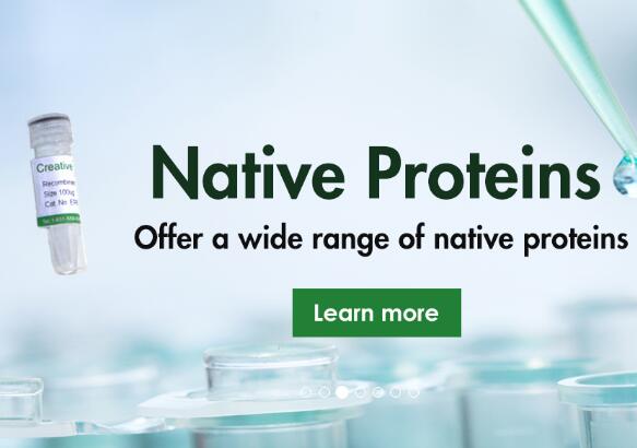Recombinant Mouse Lingo3 protein, His-tagged