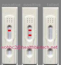 Bird flu test (H5N1)