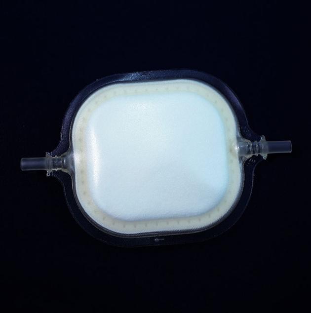 leukocyte  filter, leukodepletion blood filter