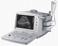 Portable Ultrasound Scanner (ZQ-6600plus)