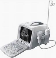 Digital Ultrasound Diagnostic System (ZQ-6601)