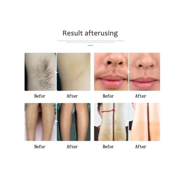 PERMANENT HAIR REMOVAL SPRAY