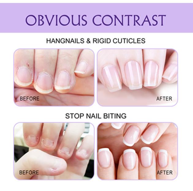 Cuticle Oil