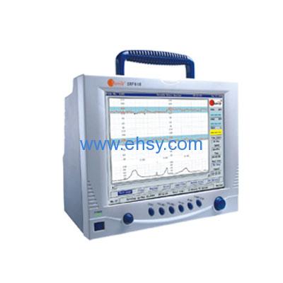 Fetal Monitor