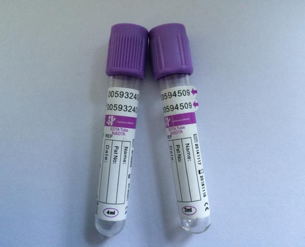K3 EDTA Blood Collection Tube With