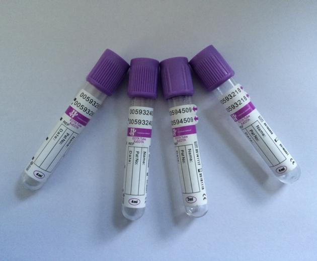 K3 EDTA Blood Collection Tube With