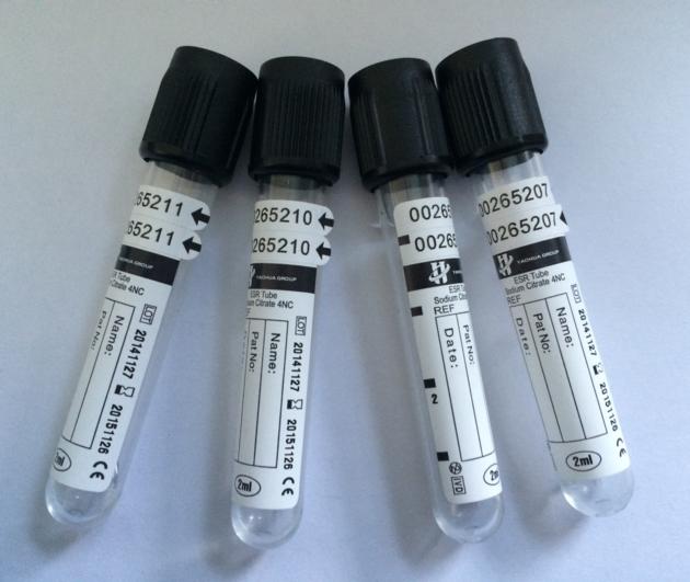 ESR Blood Collection Tube With 3