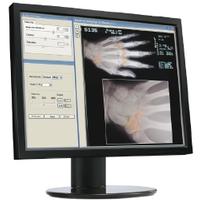 19inch High Bright HD 1.3Megapixel LCD Medical display Monitors