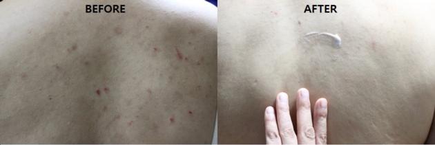 Redergen Body Bleaching Whitening Cream No