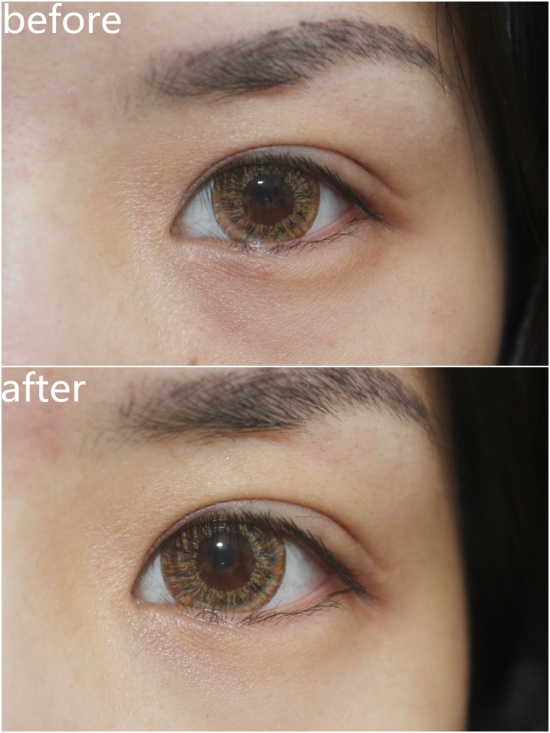Redergen Dark Circle Dark Spots Eye