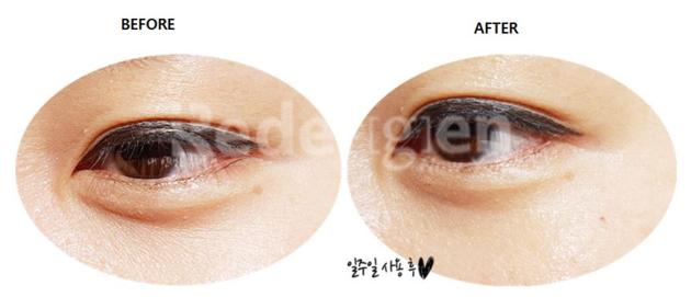 Redergen Eye Bag Remedy Under Eyes