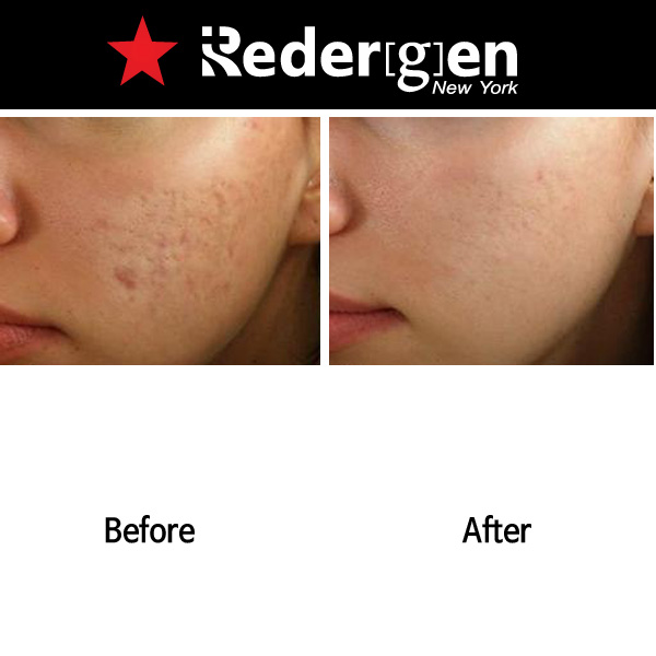 Redergen Face Brightening Cream Whitening Cream