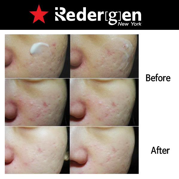 Redergen Face Brightening Cream Whitening Cream