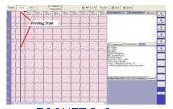 ECGNET Software