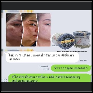 AQUA SKIN VENISCY TRIPLE STRENGTH WHITENING