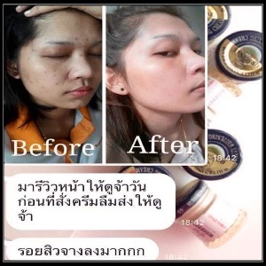 AQUA SKIN VENISCY TRIPLE STRENGTH WHITENING