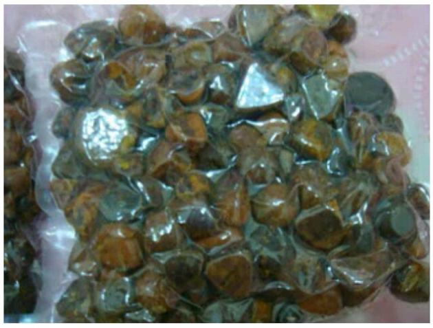 GALLSTONES