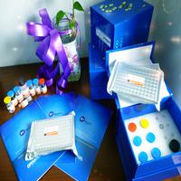 Human advanced glycation end products,AGEs ELISA Kit 