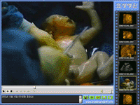 Real Time Medical Image CD Recorder