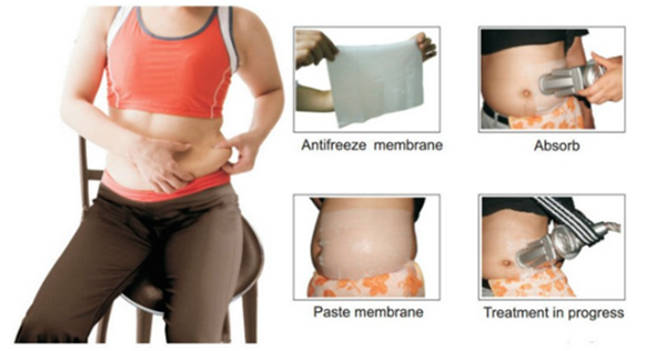 Fat Freezing Anti Freeze Membrane For