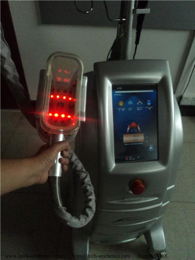 2018 Promotion Cryotherapy 3 Handles Criolipolisis
