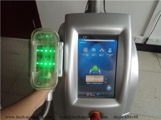 2018 Promotion Cryotherapy 3 Handles Criolipolisis