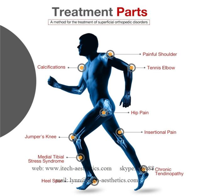 Medical Physiotherapy Equipment Treat Joint Pain