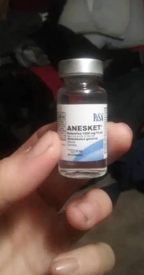 ANASKET