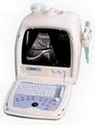 Ultrasound scanner---BW8C