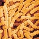 Lactobacillus paracasei