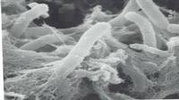 Lactobacillus Bulgaricus
